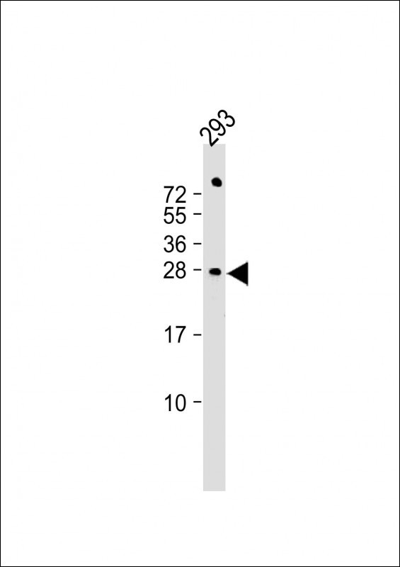 1 - RSPO2 Antibody (C-term) AP5264b