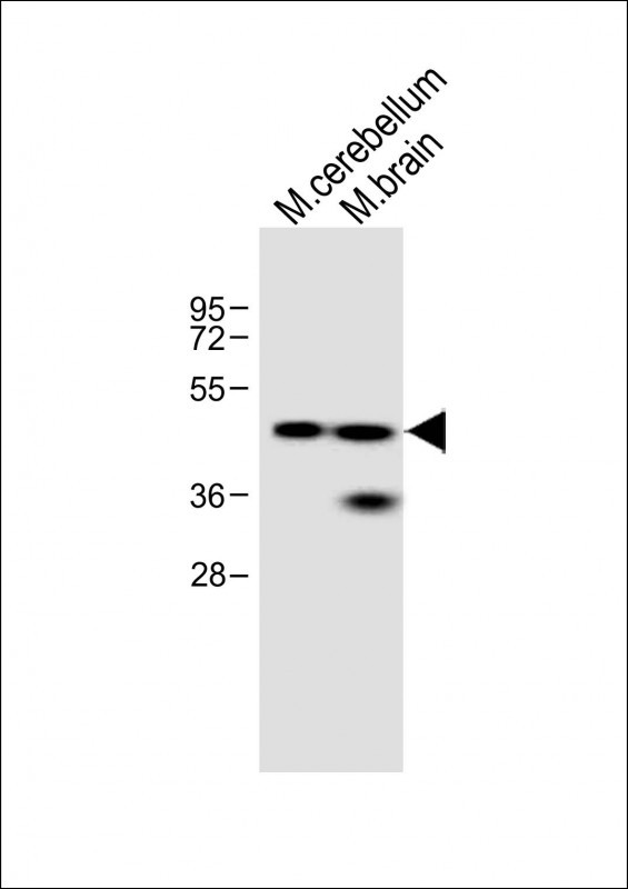 1 - Evx2 Antibody (N-term) AP1427a
