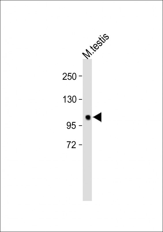 1 - POLN Antibody (C-term) AP14647b