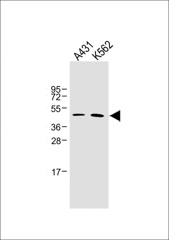 1 - ZDHHC6 Antibody (C-term) AP14848B