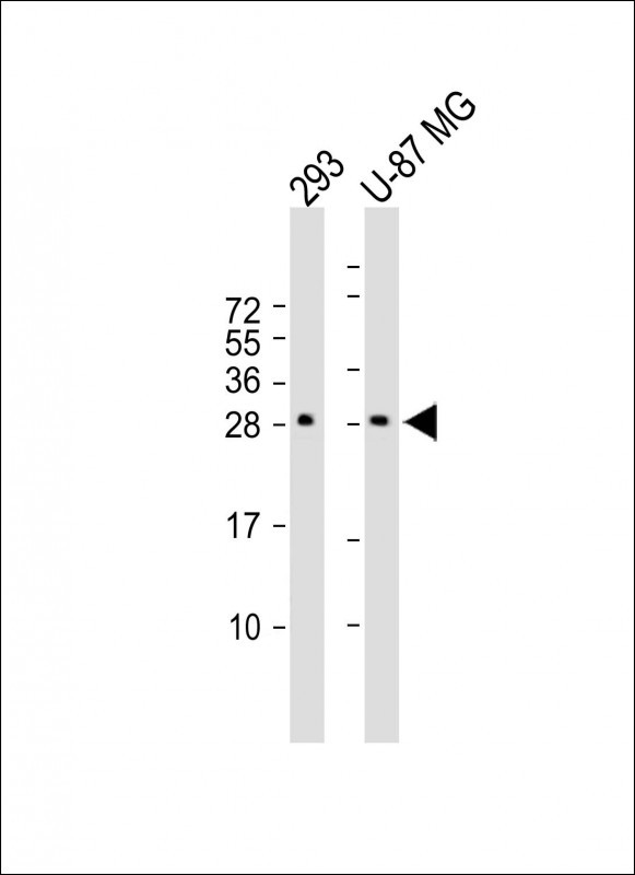 1 - RSPO2 Antibody (C-term) AP5264b