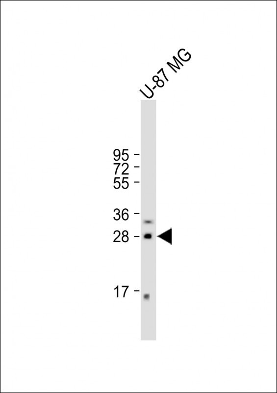 1 - RSPO2 Antibody (C-term) AP5264b
