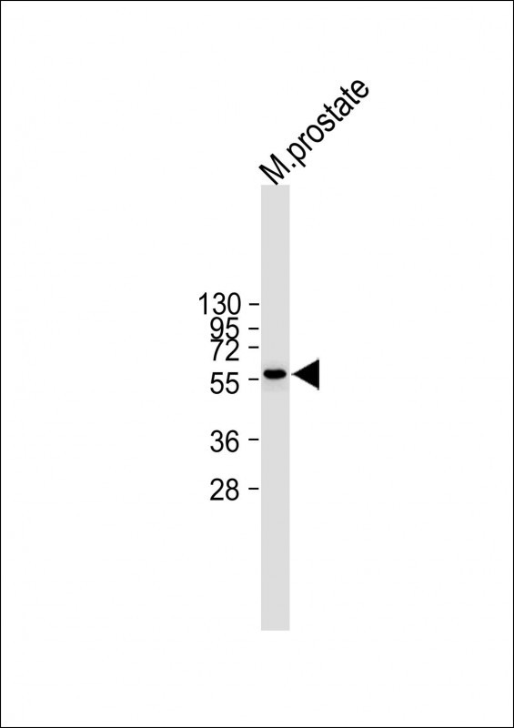 1 - TMPRSS2 Antibody (Center) AP7377c