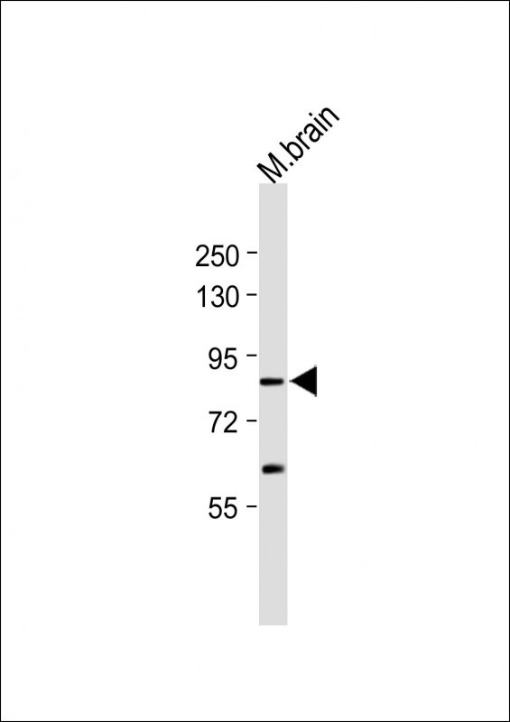 1 - C11orf63 Antibody (C-term) AP10323b