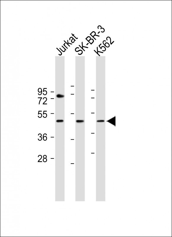1 - LOC441476 Antibody (Center) AP11401c