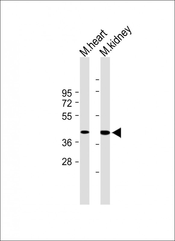 1 - TMEM120A Antibody (N-term) AP11729a