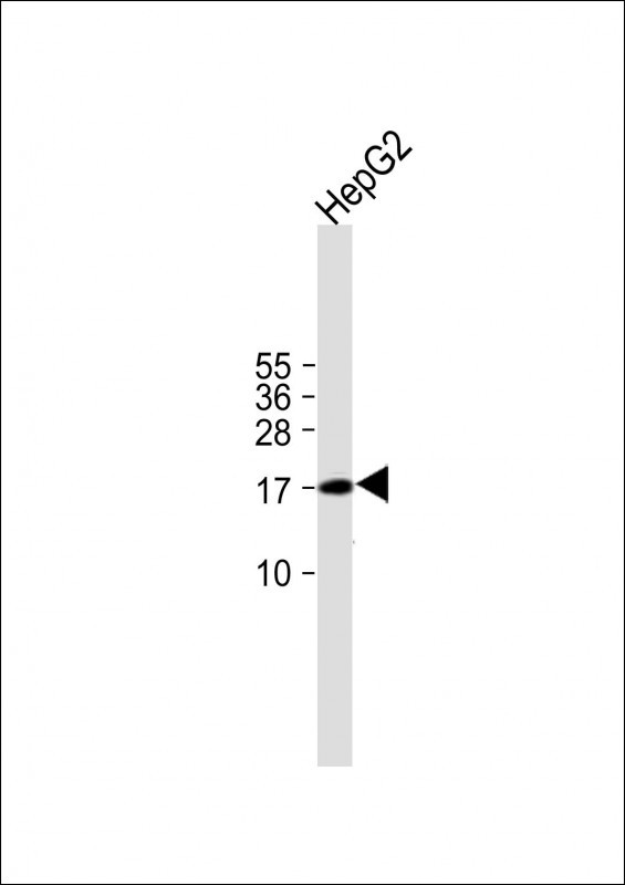 1 - UNQ5814 Antibody (C-term) AP11911b