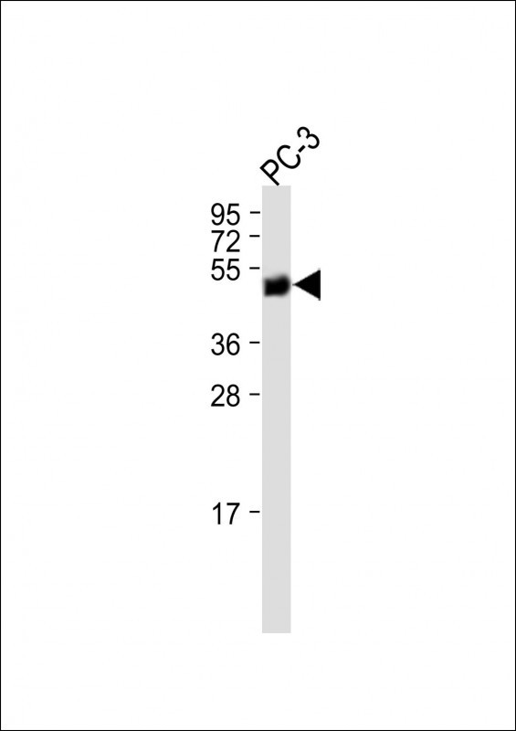 1 - KRT37 Antibody (Center) AP13514c
