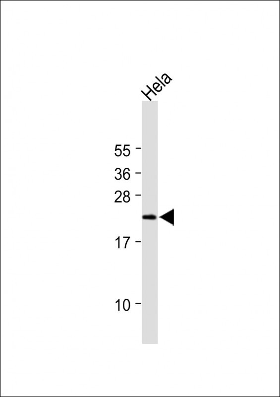 1 - IL19 Antibody (N-term) AP17156a
