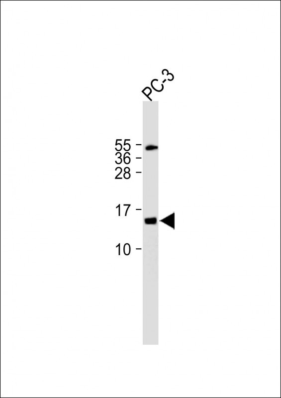 1 - FUNDC2 Antibody (C-term) AP20155b