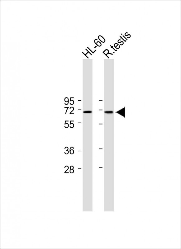 1 - RNGTT Antibody (C-term) AP6617b