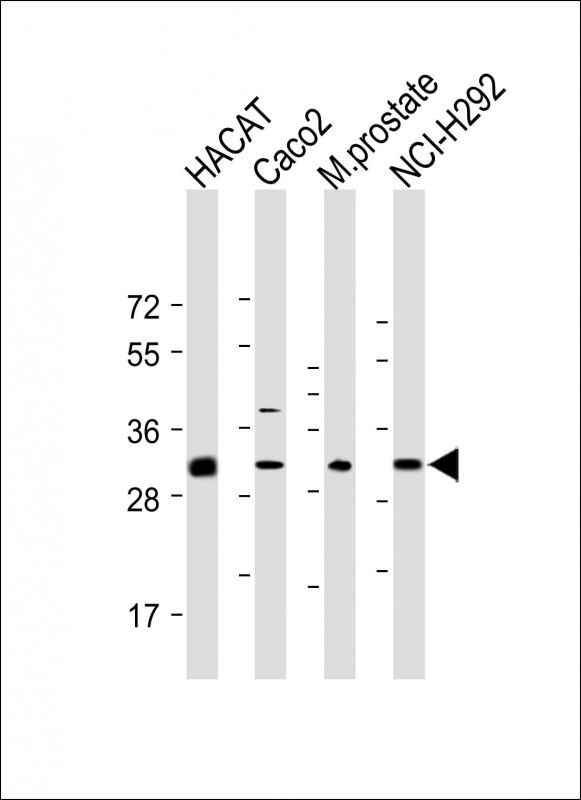 1 - UPK1B Antibody (Center) AP9725c