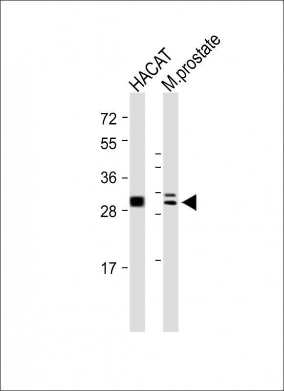 1 - UPK1B Antibody (Center) AP9725c