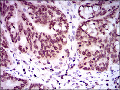 14 - RTR (2B11) Mouse mAb AP53512