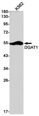 1 - DGAT1 Rabbit pAb AP53607