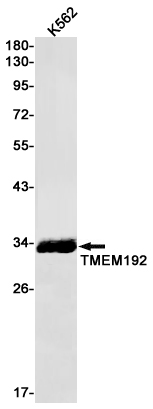 1 - TMEM192 Rabbit pAb AP53620