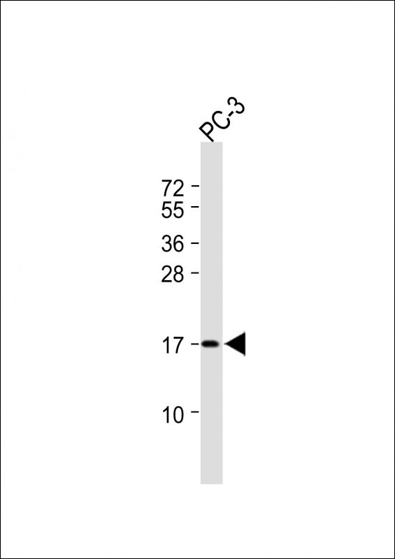 1 - CCDC58 Antibody (N-term) AP12660a