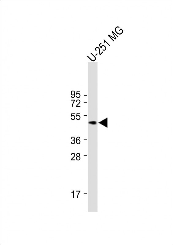 1 - Mouse Mapkapk5 Antibody (N-term) AP14447a