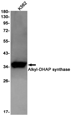 1 - AGPS Rabbit pAb AP53542