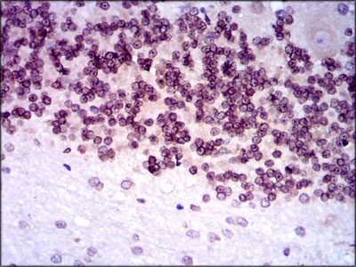 14 - RTR (2B11) Mouse mAb AP53512