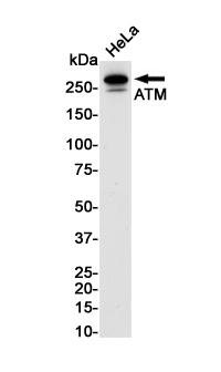 1 - ATM Rabbit pAb AP53544