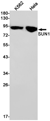 1 - SUN1 Rabbit pAb AP53606