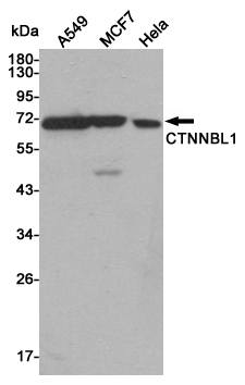 1 - CTNNBL1 Mouse mAb AP53515