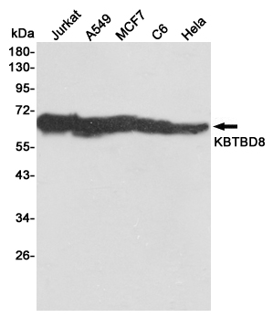 1 - KBTBD8 Mouse mAb AP53516