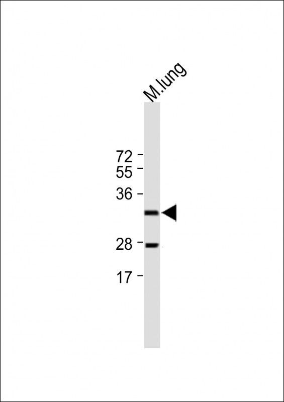 1 - EFNB2 Antibody (Center) AP11652C