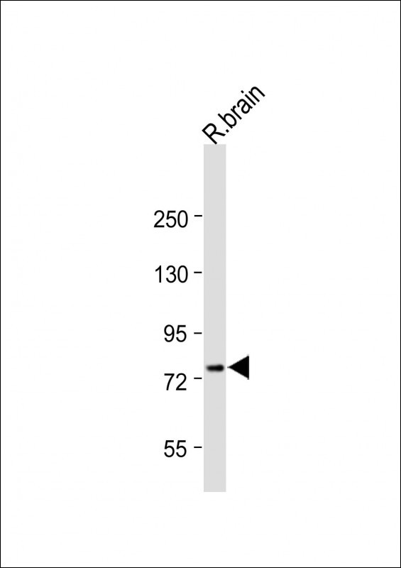 1 - Mouse Adrbk1 Antibody (C-term) AP13797b
