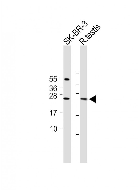 1 - TMEM40 Antibody (N-term) AP5813a
