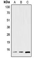 1 - Anti-Spasmolysin Antibody AP53706
