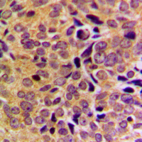 2 - Anti-GAS8 Antibody AP53777