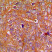 2 - Anti-CARD14 Antibody AP53785