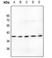 1 - Anti-LDLRAD3 Antibody AP53790