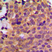 2 - Anti-CK1 alpha Antibody AP53794
