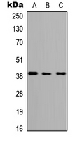 1 - Anti-ABHD4 Antibody AP53839