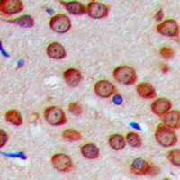2 - Anti-GTPBP5 Antibody AP53851