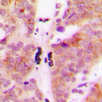 2 - Anti-KLHL29 Antibody AP53854