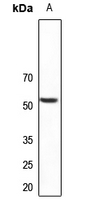1 - Anti-PLXDC1 Antibody AP53861