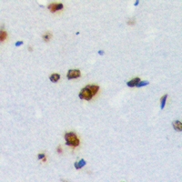2 - Anti-ZNF668 Antibody AP53913