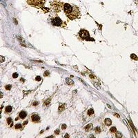 2 - Anti-ASF1B Antibody AP53915