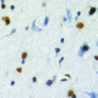 2 - Anti-TBL2 Antibody AP53923