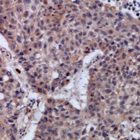2 - Anti-SETMAR Antibody AP53938