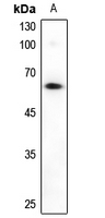 1 - Anti-Alpha-taxilin Antibody AP53940