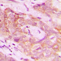 2 - Anti-DUS2L Antibody AP53951