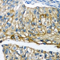 2 - Anti-POTEG Antibody AP53969