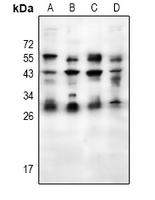 1 - Anti-Placental lactogen Antibody AP53997