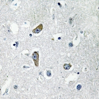 2 - Anti-CDK5RAP2 Antibody AP54033