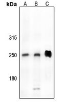 1 - Anti-CDK5RAP2 Antibody AP54033